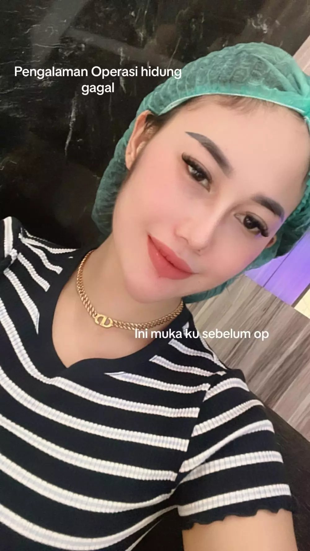 Kisah cewek gagal operasi hidung © 2024 TikTok