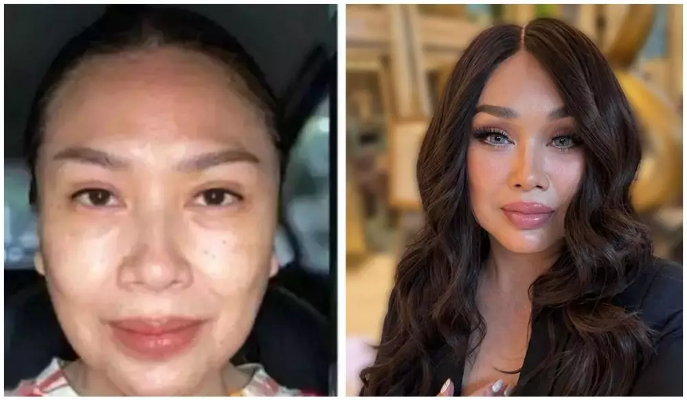 Dian Nitami putuskan operasi wajah berbagai sumber