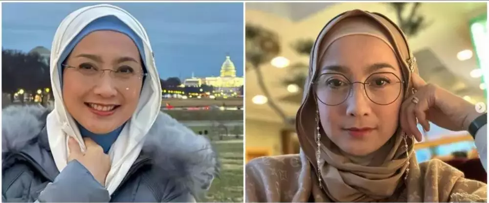 Dian Nitami putuskan operasi wajah berbagai sumber