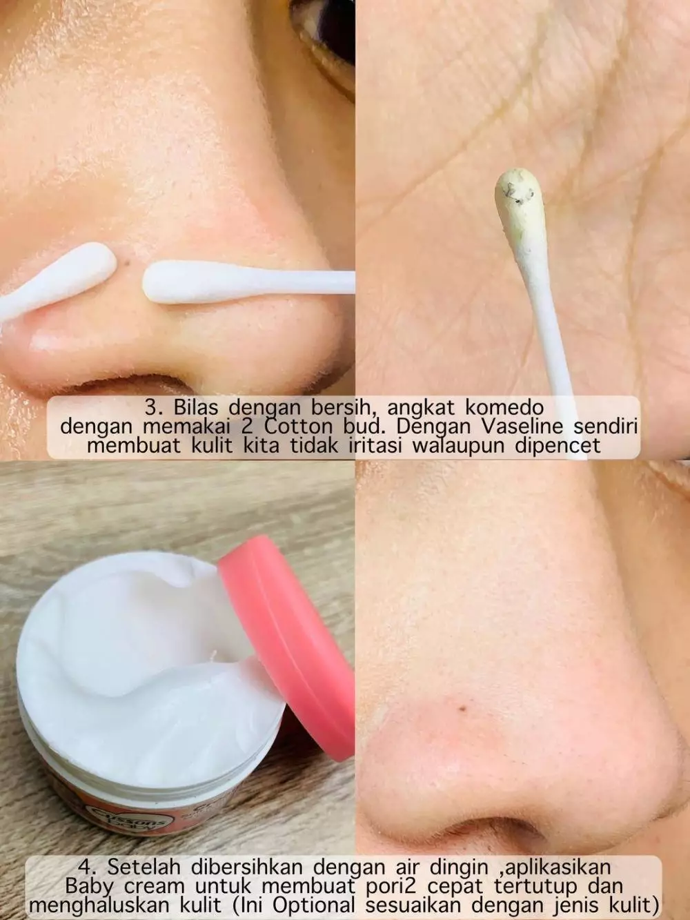cara hilangkan komedo pakai 2 kombinasi. berbagai sumber