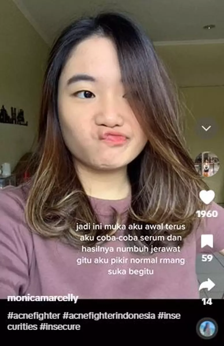 Wajah mulus cewek jadi jerawatan parah usai pakai iseng gonta ganti serum TikTok