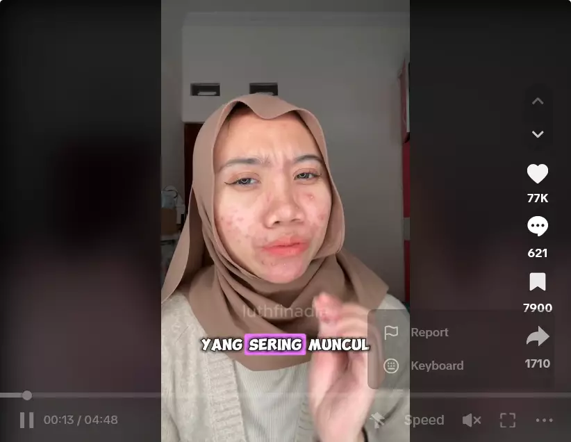 cewek ini bagikan kisahnya alami rosacea © 2024 TikTok cewek ini bagikan kisahnya alami rosacea © 2024 TikTok