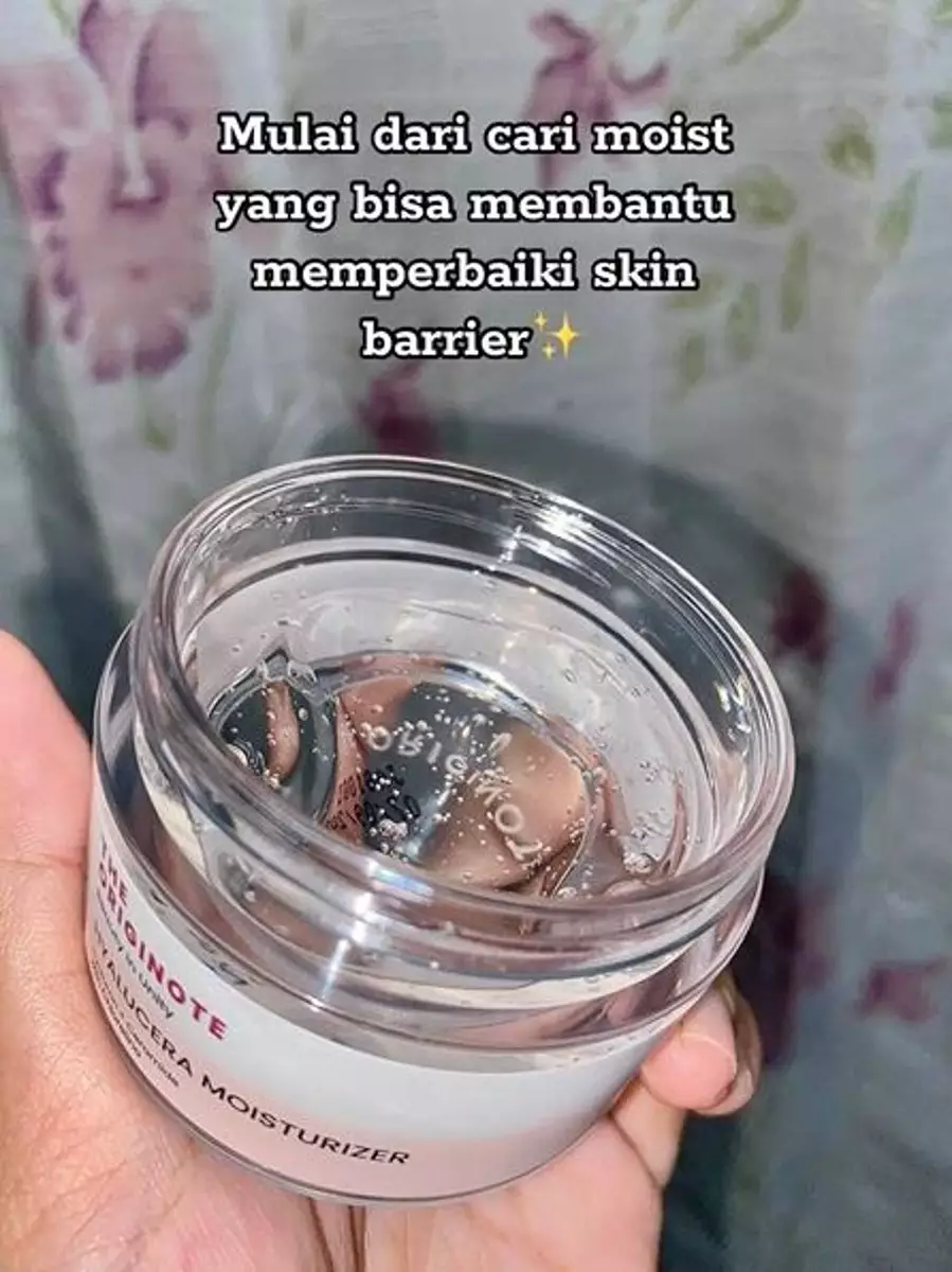 Cewek ini alami breakout di wajahnya efek over eksfoliasi TikTok Cewek ini alami breakout di wajahnya efek over eksfoliasi TikTok