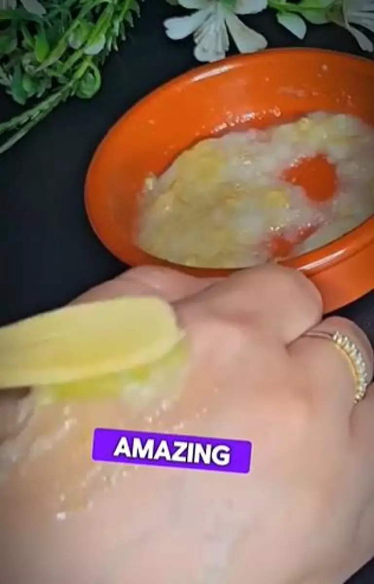 Buah rasa asam bisa putihkan gigi kuning dan atasi bau mulut tak sedap Berbagai sumber