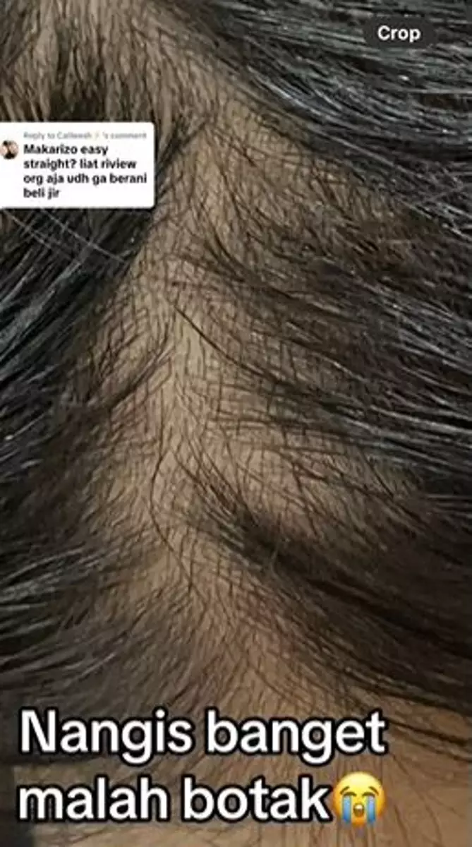 Kisah nyesek wanita rambut rapuh pakai obat pelurus TikTok Kisah nyesek wanita rambut rapuh pakai obat pelurus TikTok