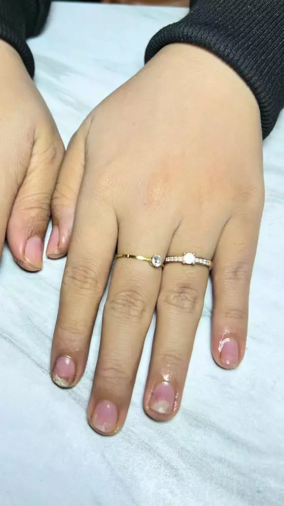 kuku jadi rusak akibat nail extension © 2024 TikTok kuku jadi rusak akibat nail extension © 2024 TikTok