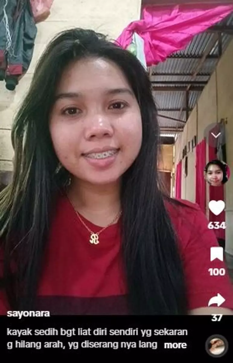 Wajah cewek penuh flek hitam akibat gonta-ganti skincare TikTok Wajah cewek penuh flek hitam akibat gonta-ganti skincare TikTok