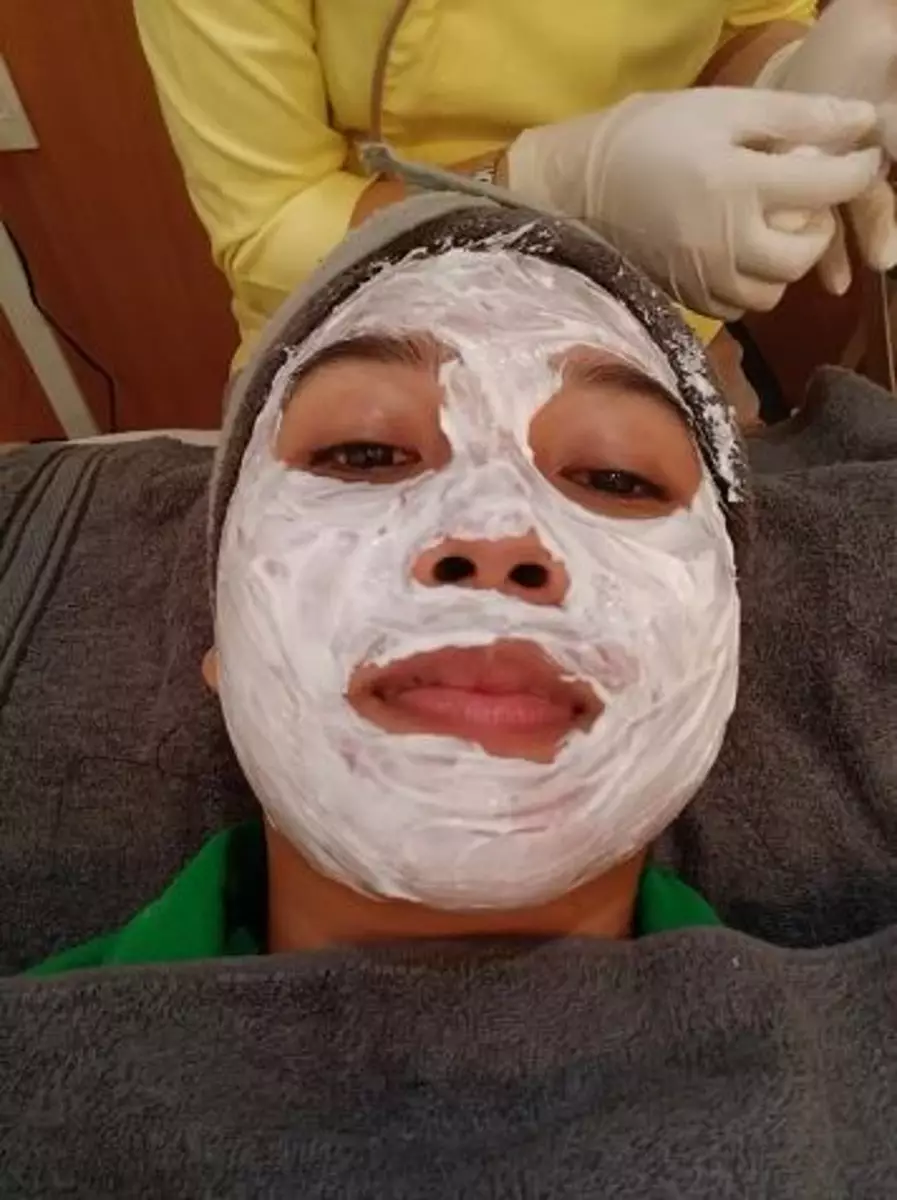 Wajah cewek penuh flek hitam akibat gonta-ganti skincare TikTok Wajah cewek penuh flek hitam akibat gonta-ganti skincare TikTok