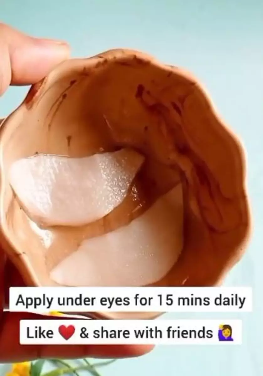 Cara pudarkan mata panda membandel cuma andalkan 1 umbi-umbian Berbagai sumber