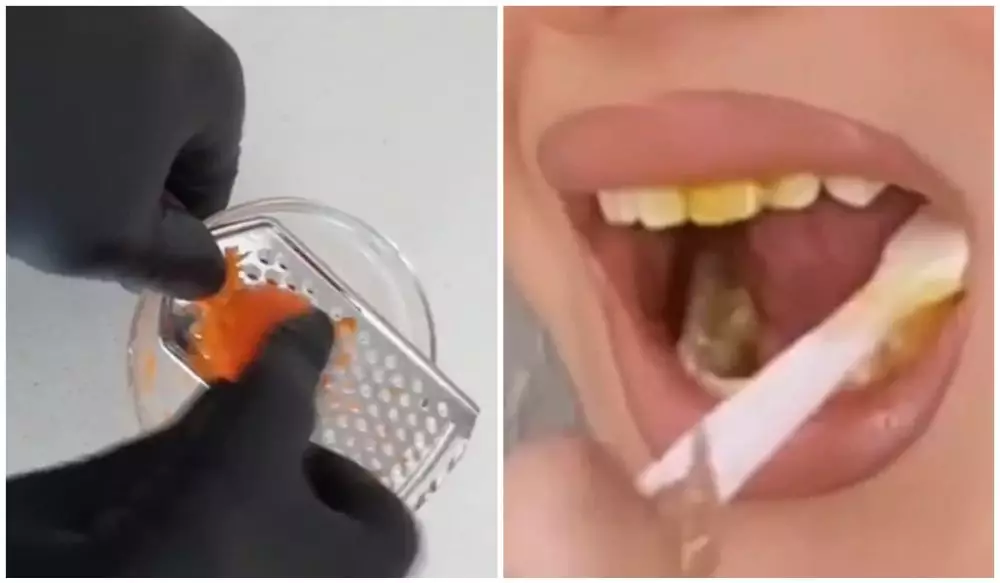 cara pudarkan gigi kuning agar putih. © 2024 Instagram