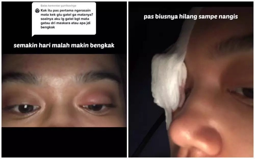 kisah wanita matanya jadi bintitan pakai maskara © 2024 TikTok kisah wanita matanya jadi bintitan pakai maskara © 2024 TikTok