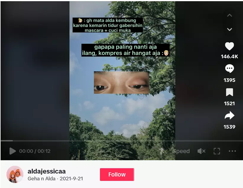 kisah wanita matanya jadi bintitan pakai maskara © 2024 TikTok kisah wanita matanya jadi bintitan pakai maskara © 2024 TikTok