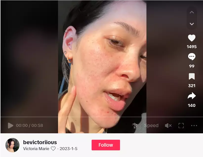 Wanita ini alami ruam usai pakai skincare © 2024 TikTok