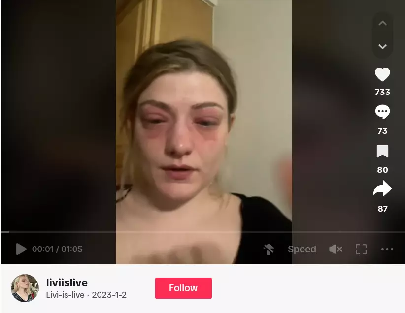 wanita ini diduga alergi palet eyeshadow © 2024 TikTok
