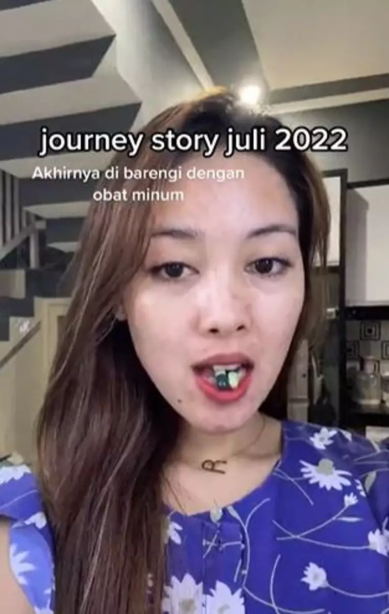 Kisah cewek sembuh dari jerawat hormonal ini penuh perjuangan TikTok