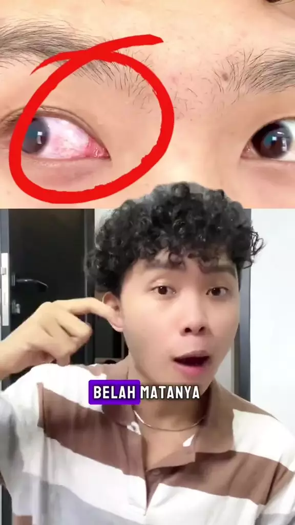 iritasi pada mata usai pakai concealer © 2024 TikTok  iritasi pada mata usai pakai concealer © 2024 TikTok