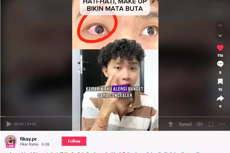 iritasi pada mata usai pakai concealer © 2024 TikTok  iritasi pada mata usai pakai concealer © 2024 TikTok