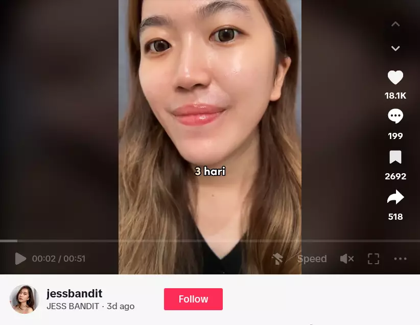 review Skintific Acid Peeling Solution Serum berbagai sumber review Skintific Acid Peeling Solution Serum berbagai sumber
