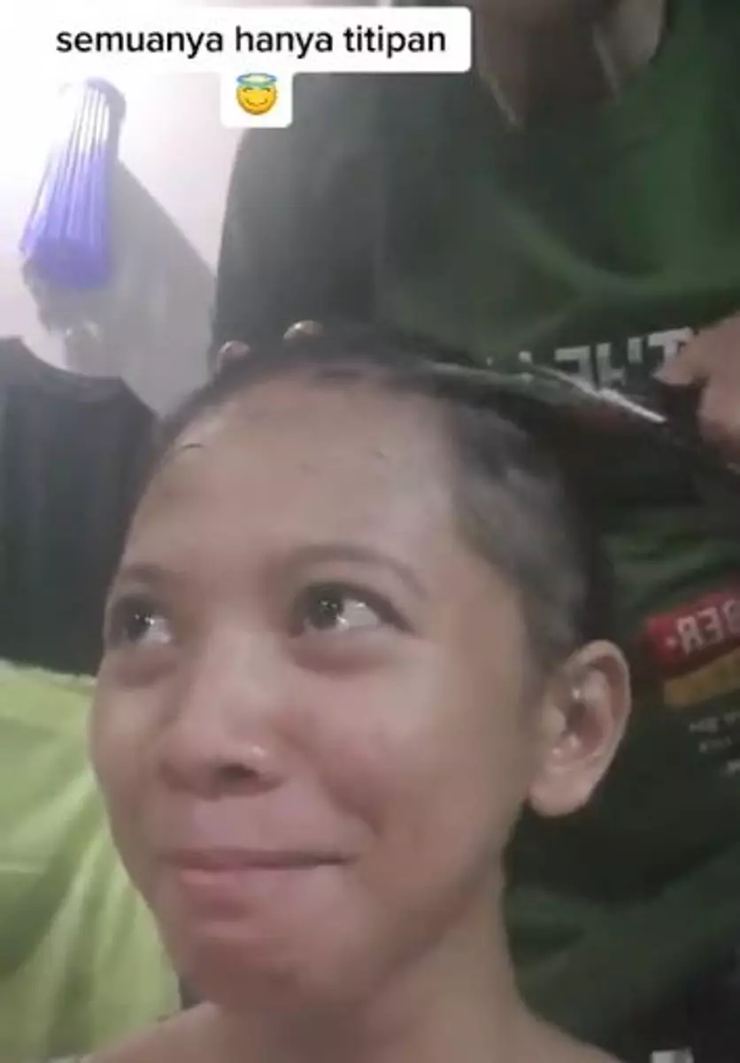 Kisah rambut cewek dipotong botak akibat ketombe TikTok