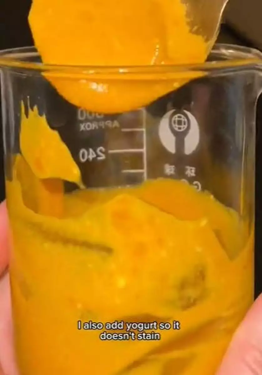 Produk olahan susu bisa pudarkan pigmentasi di wajah Berbagai sumber Produk olahan susu bisa pudarkan pigmentasi di wajah Berbagai sumber