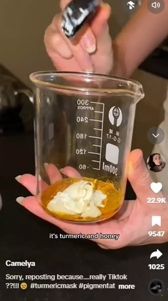 Produk olahan susu bisa pudarkan pigmentasi di wajah Berbagai sumber Produk olahan susu bisa pudarkan pigmentasi di wajah Berbagai sumber