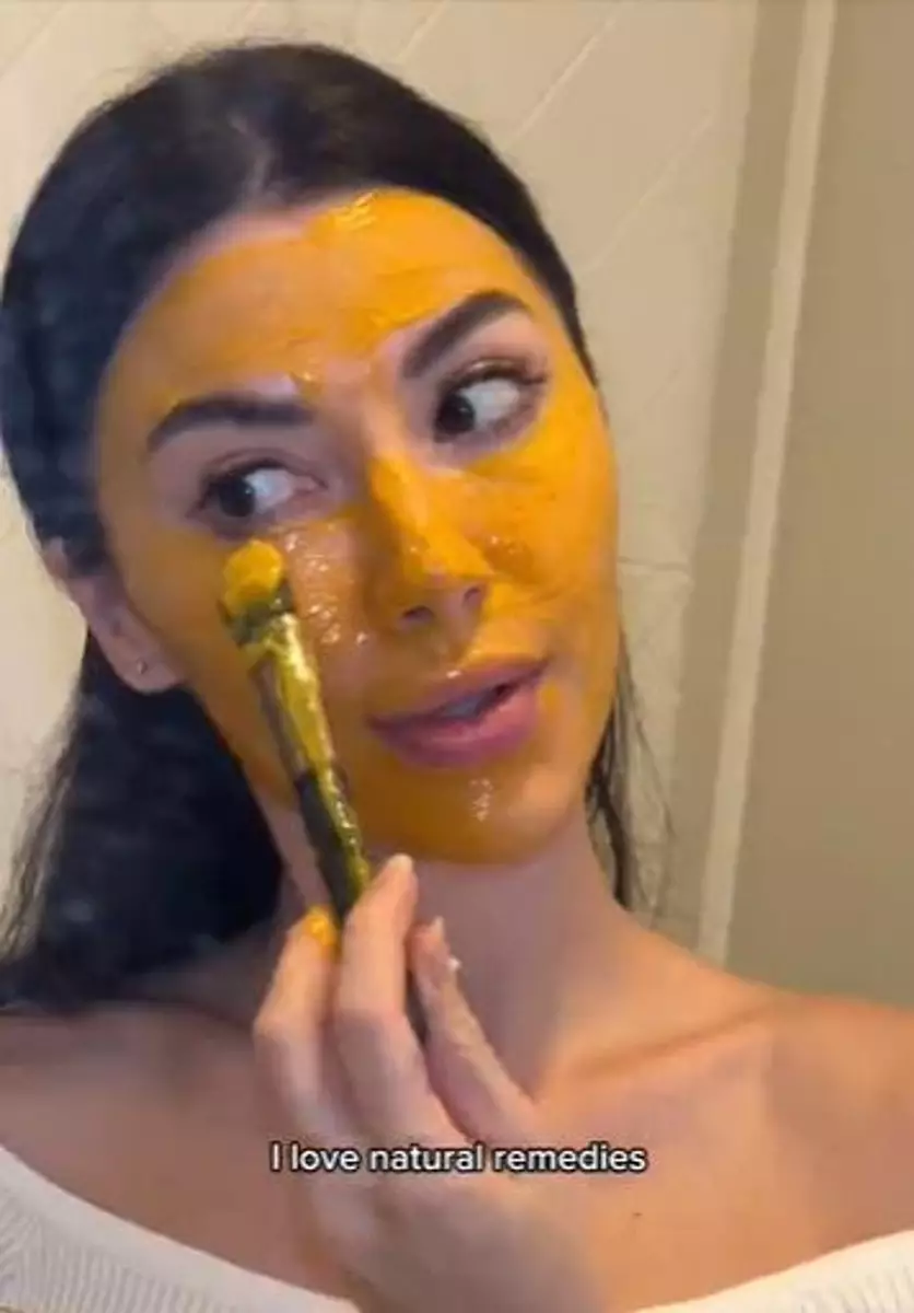 Produk olahan susu bisa pudarkan pigmentasi di wajah Berbagai sumber Produk olahan susu bisa pudarkan pigmentasi di wajah Berbagai sumber