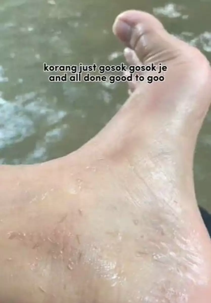 Cewek hilangkan daki di kulit dalam hitungan menit cuma modal Rp 0 TikTok