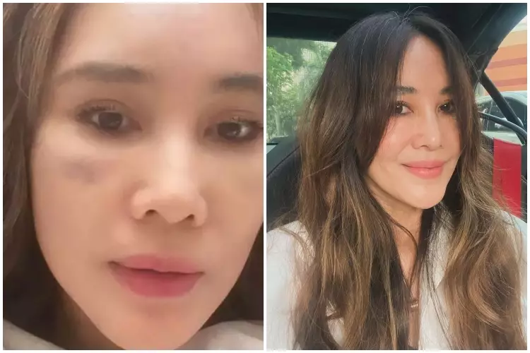 Seleb ini lakukan oplas namun wajahnya tak banyak berubah Berbagai sumber Seleb ini lakukan oplas namun wajahnya tak banyak berubah Berbagai sumber