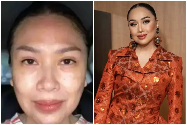 Seleb ini lakukan oplas namun wajahnya tak banyak berubah Berbagai sumber Seleb ini lakukan oplas namun wajahnya tak banyak berubah Berbagai sumber
