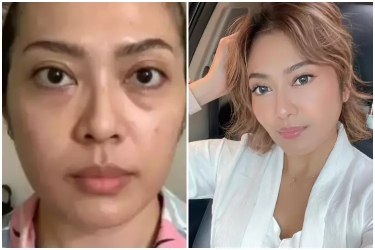 Seleb ini lakukan oplas namun wajahnya tak banyak berubah Berbagai sumber Seleb ini lakukan oplas namun wajahnya tak banyak berubah Berbagai sumber