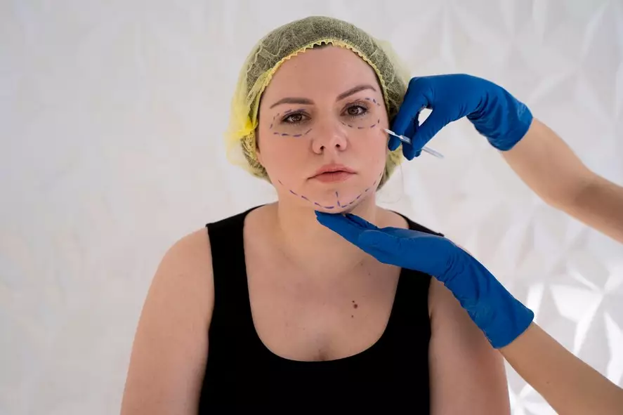 mengenal sedot lemak © 2024 freepik.com