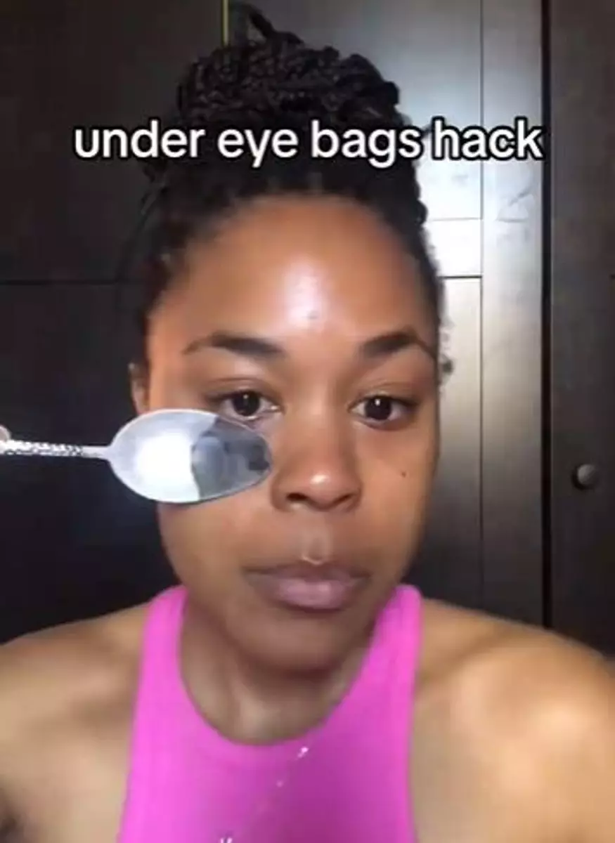 Trik kempiskan kantung mata tebal cuma pakai 1 alat makan Berbagai sumber Trik kempiskan kantung mata tebal cuma pakai 1 alat makan Berbagai sumber