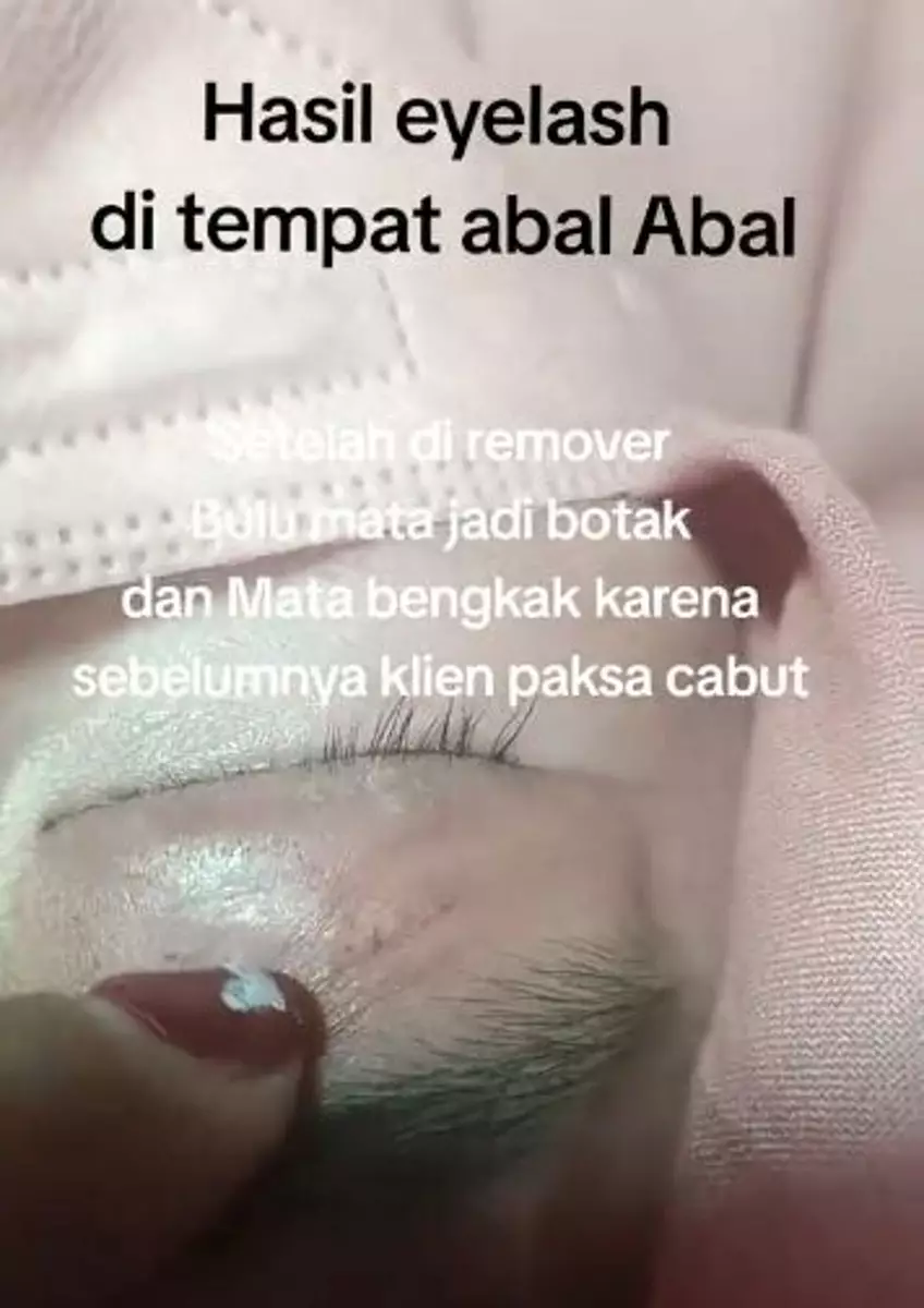 Cewek pasang eyelash extension biar cantik malah berujung sial TikTok Cewek pasang eyelash extension biar cantik malah berujung sial TikTok