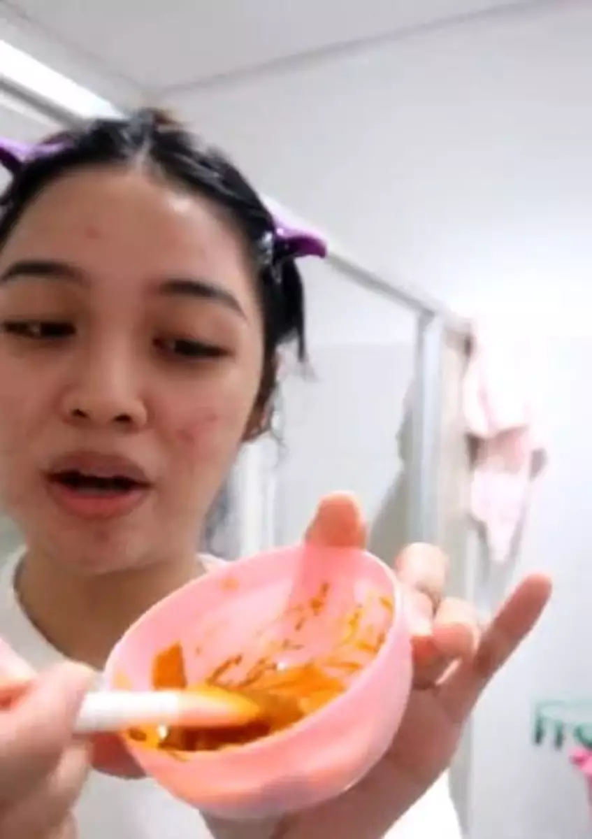 Campuran susu dan rempah dapur bisa meredakan peradangan jerawat Berbagai sumber Campuran susu dan rempah dapur bisa meredakan peradangan jerawat Berbagai sumber