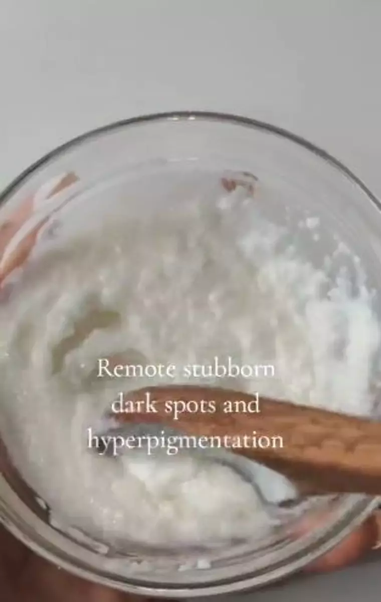 Campuran susu dan 2 bahan dapur bisa atasi flek hitam di wajah Berbagai sumber Campuran susu dan 2 bahan dapur bisa atasi flek hitam di wajah Berbagai sumber