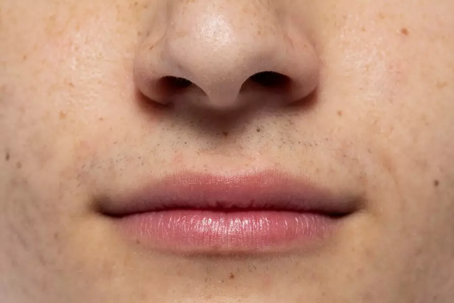 sunscreen closed comedo © 2024 freepik.com