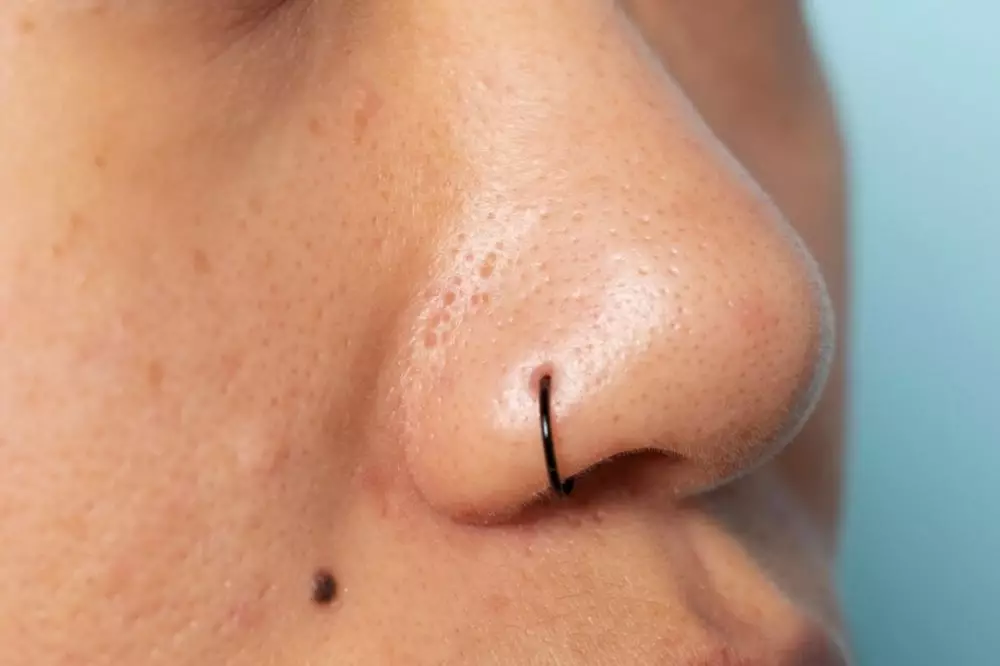 sunscreen closed comedo © 2024 freepik.com