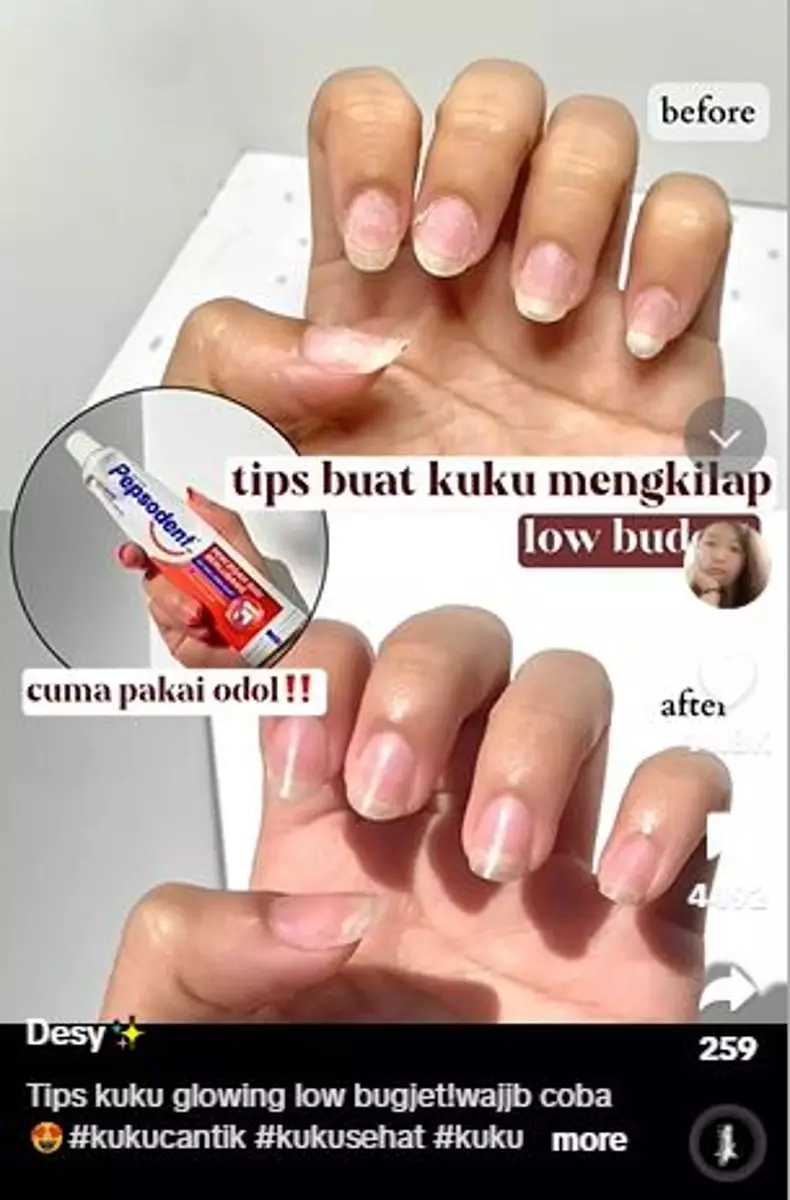 Fungsi lain pasta gigi untuk mempercantik kuku Berbagai sumber
