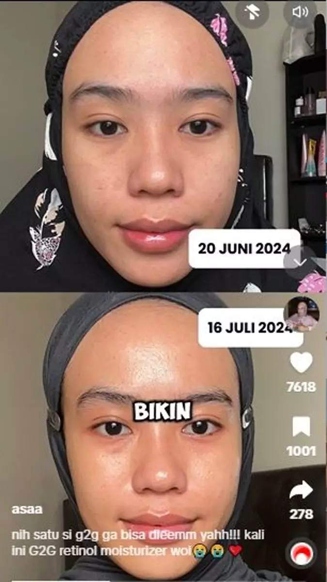Review pelembap retinol Glad2Glow mampu cerahkan wajah dalam 20 hari TikTok