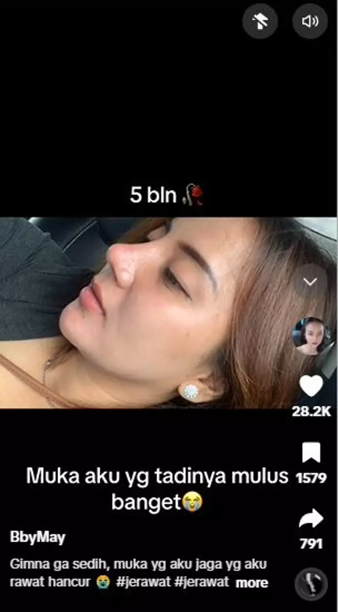 Perubahan kulit cewek usai pakai skincare nggak cocok ini bikin miris TikTok