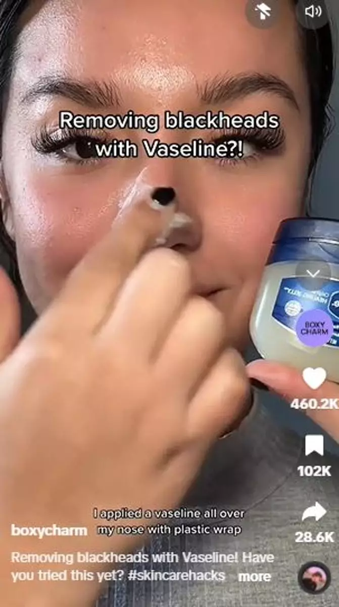 Produk pelembap ini bisa atasi komedo membandel di hidung Berbagai sumber