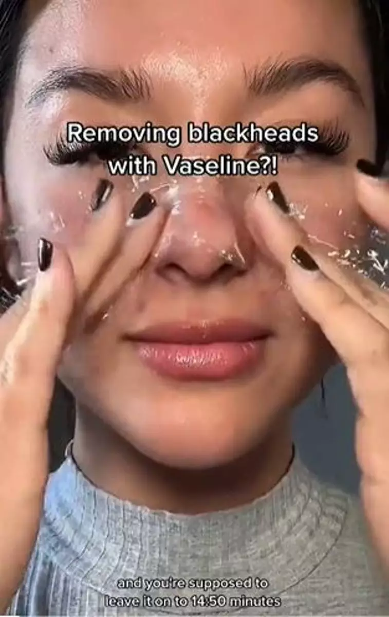 Produk pelembap ini bisa atasi komedo membandel di hidung Berbagai sumber