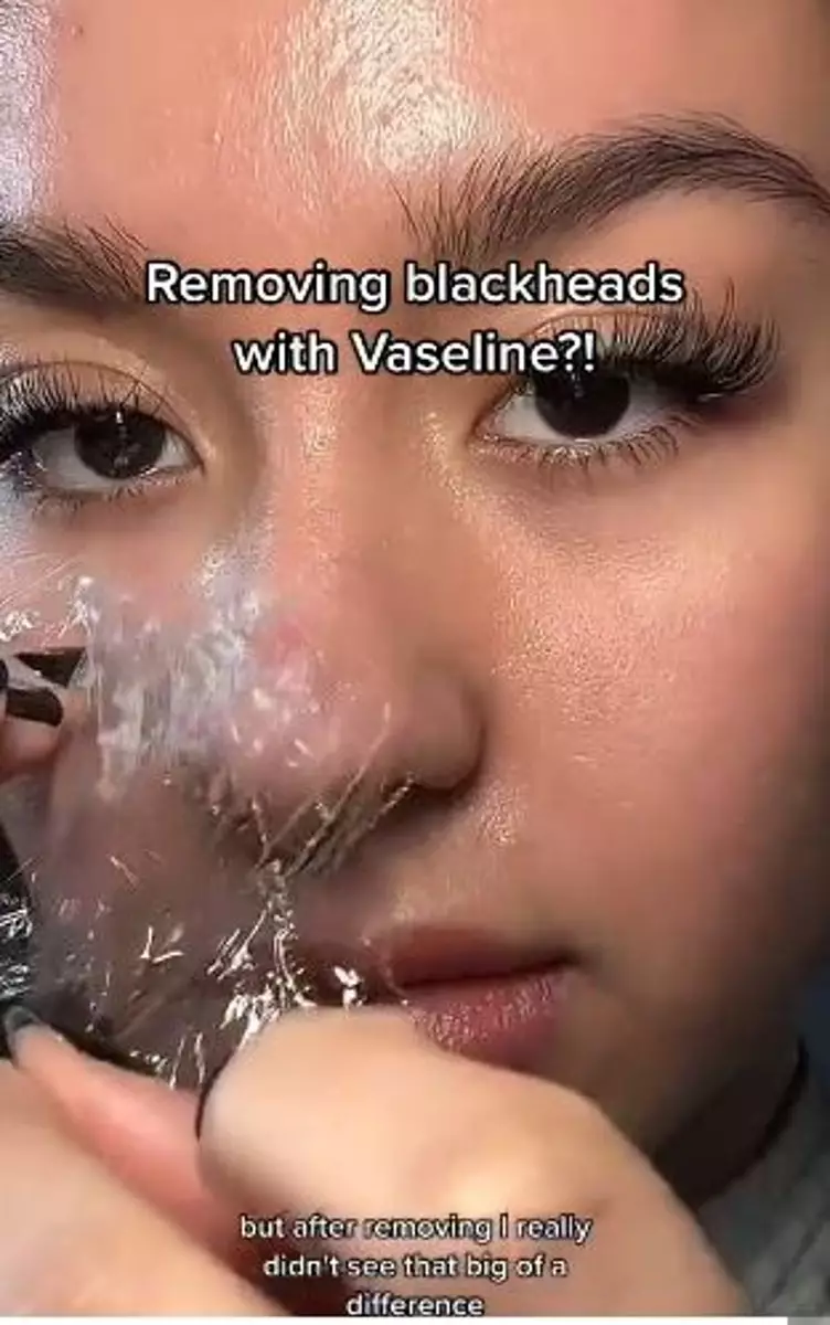 Produk pelembap ini bisa atasi komedo membandel di hidung Berbagai sumber