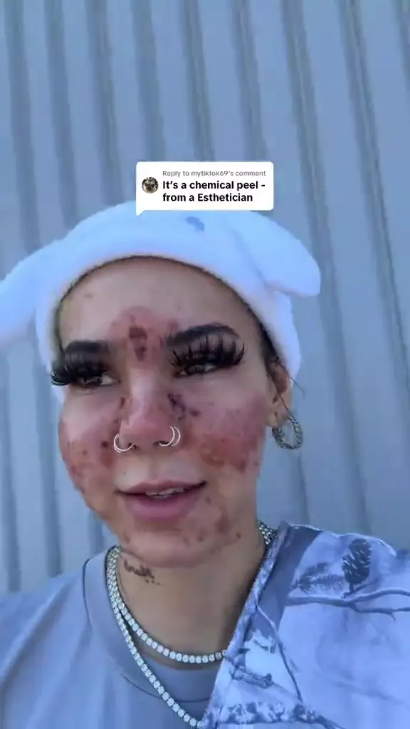 wajah rusak pakai skincare kadaluarsa berbagai sumber wajah rusak pakai skincare kadaluarsa berbagai sumber