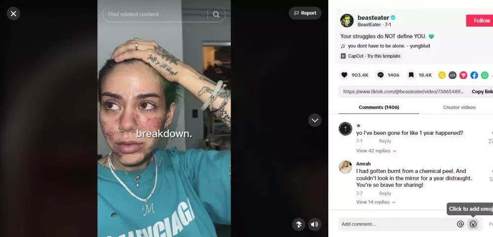 wajah rusak pakai skincare kadaluarsa berbagai sumber wajah rusak pakai skincare kadaluarsa berbagai sumber