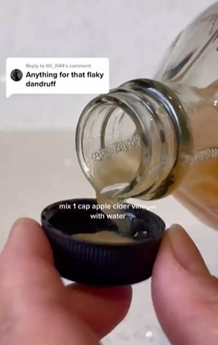 Trik atasi ketombe membandel cuma pakai 1 jenis produk fermentasi Berbagai sumber