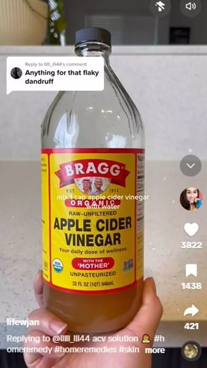 Trik atasi ketombe membandel cuma pakai 1 jenis produk fermentasi Berbagai sumber