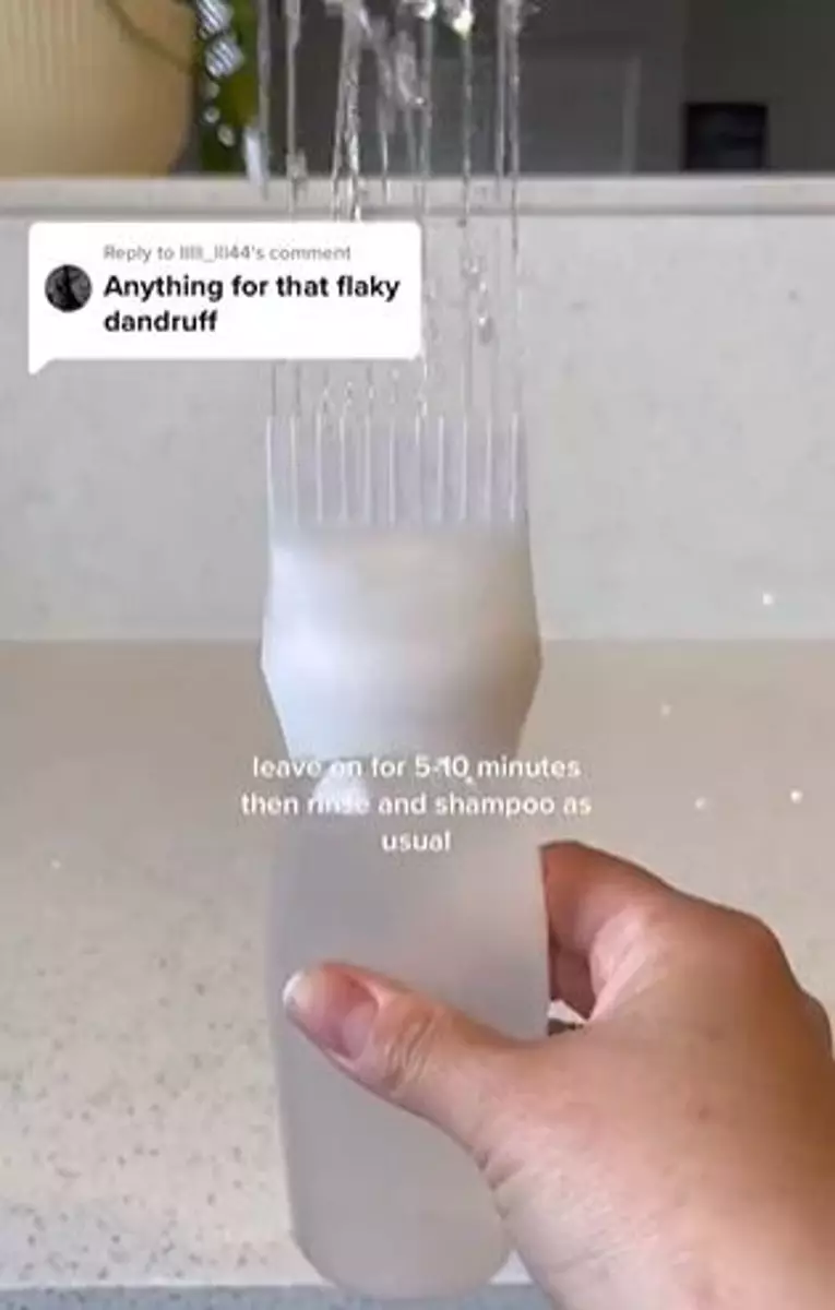 Trik atasi ketombe membandel cuma pakai 1 jenis produk fermentasi Berbagai sumber