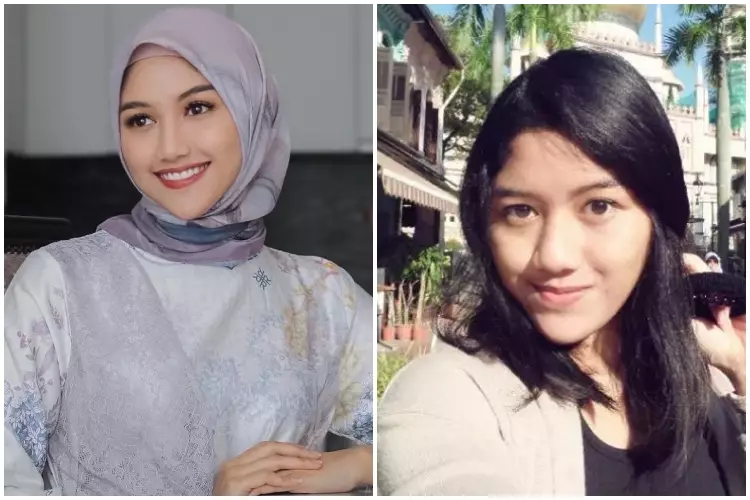 7 Potret Erina Gudono saat pakai dan tanpa makeup Berbagai sumber 7 Potret Erina Gudono saat pakai dan tanpa makeup Berbagai sumber