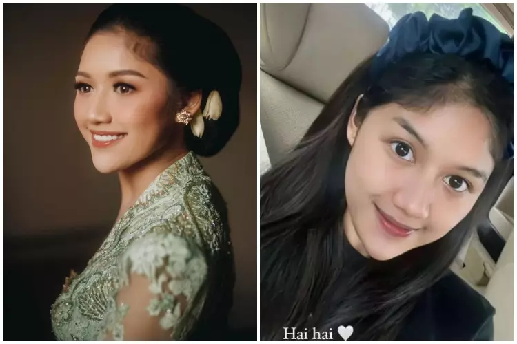 7 Potret Erina Gudono saat pakai dan tanpa makeup Berbagai sumber 7 Potret Erina Gudono saat pakai dan tanpa makeup Berbagai sumber